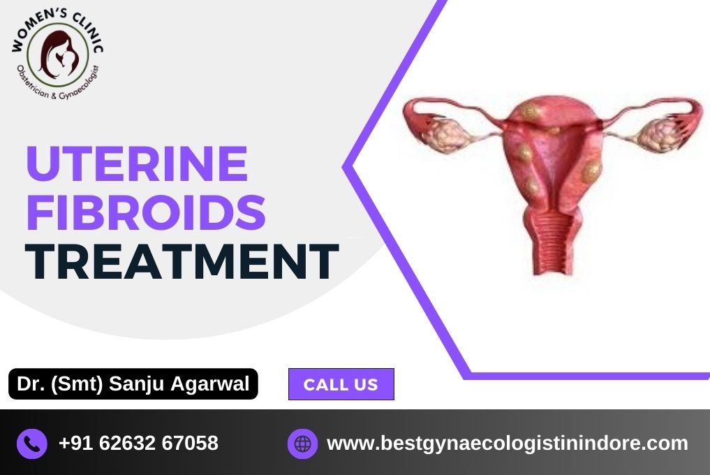 Uterine Fibroids Treatment in Indore