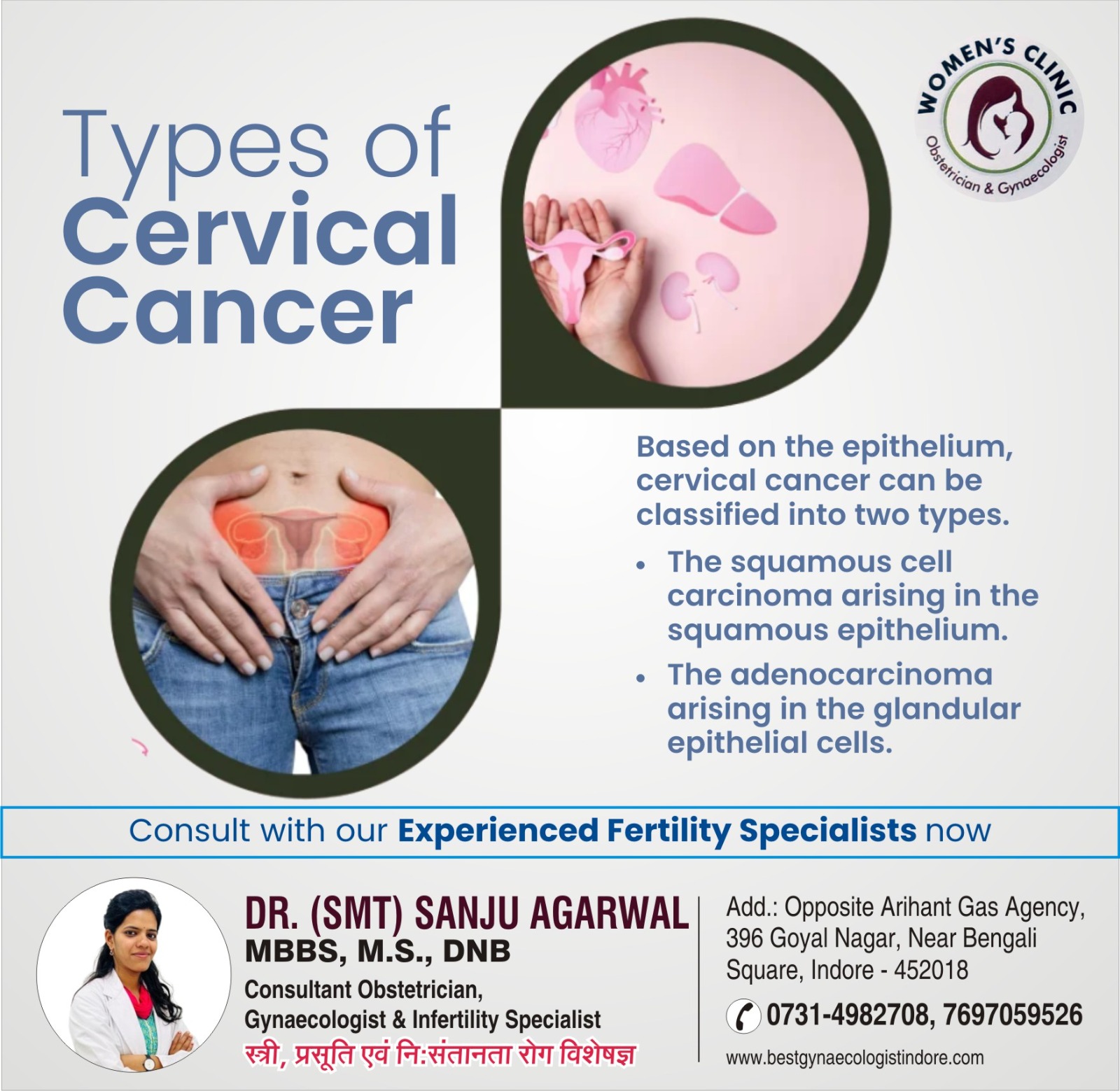 Best Cervical Cancer Specialist in Indore